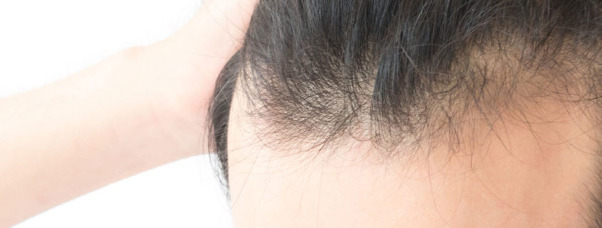 lichtes Haar